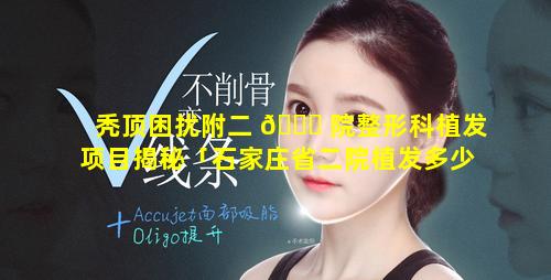 秃顶困扰附二 🐋 院整形科植发项目揭秘「石家庄省二院植发多少钱」